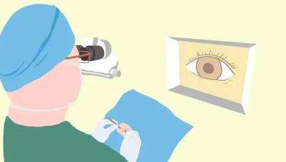 艾格眼科近视激光手术做的好吗？